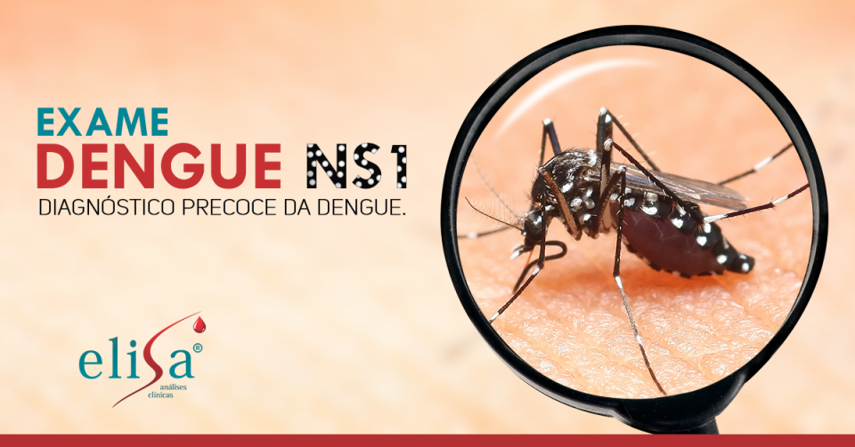 Elisa Análises Clínicas Blog Exame DENGUE NS diagnóstico precoce da dengue